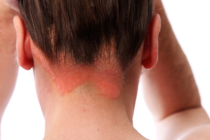 Injured at a Beauty Salon? You Might Have a Legal Case! — Arash Law