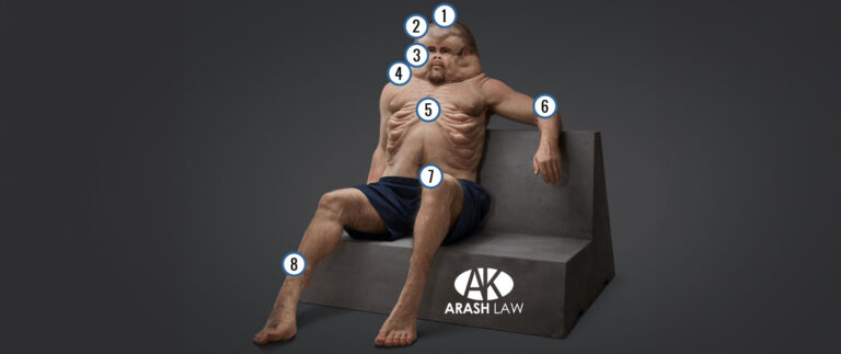 arash ley graham cuerpo