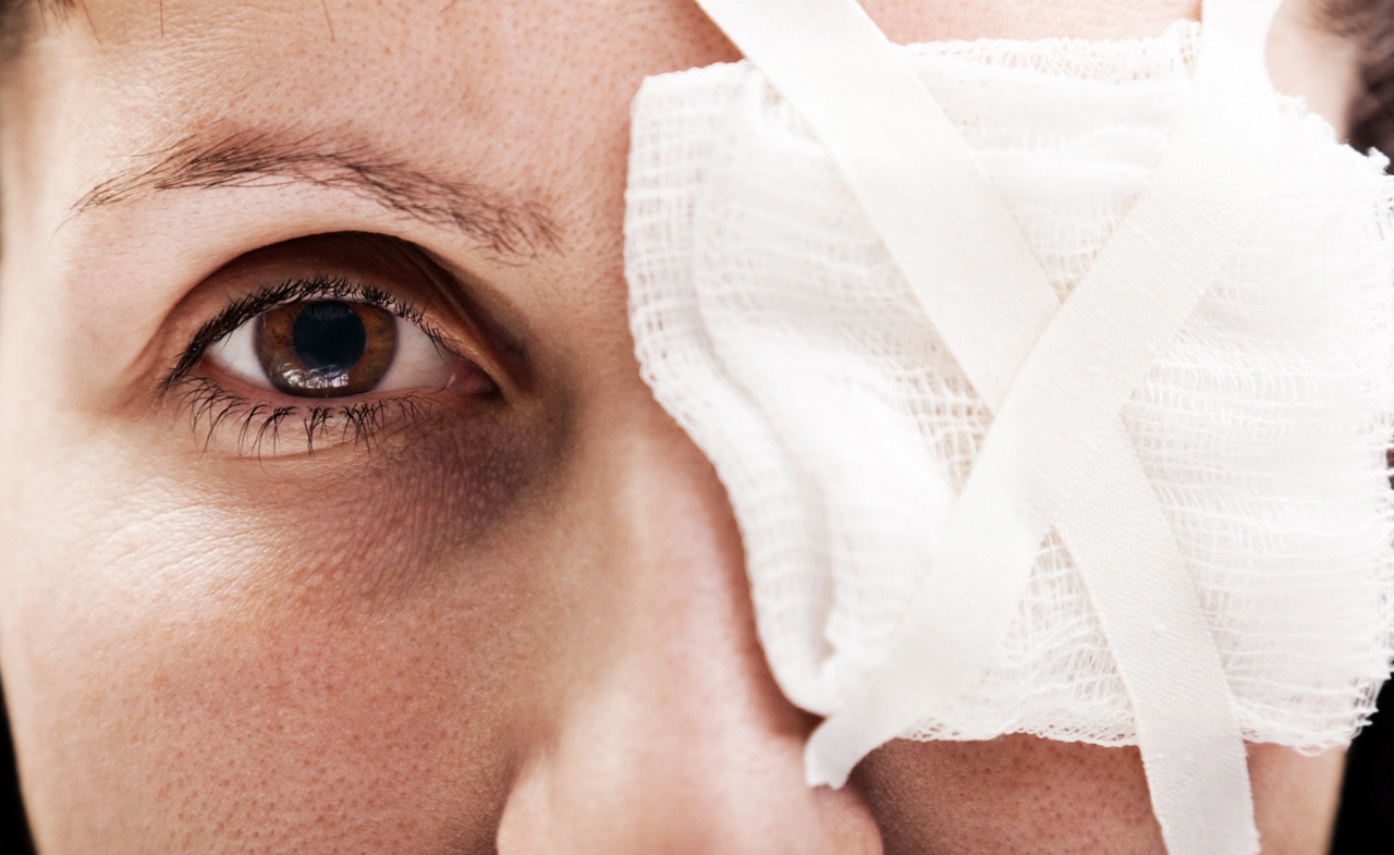 Eye Injuries