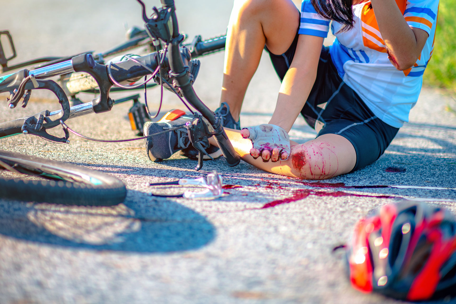 Bike injuries cause serious injuries in Orange County