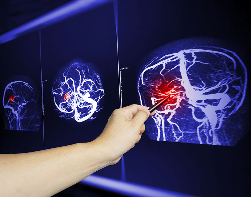 different categories of brain injuries