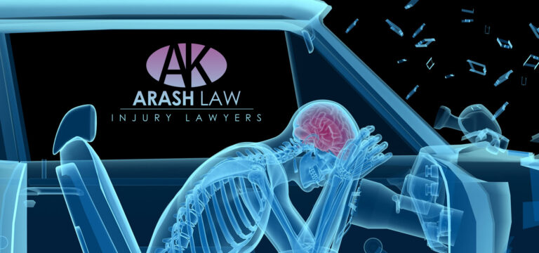 Qué Tipos de Accidentes Automovilísticos Causan Lesiones Cerebrales Traumáticas