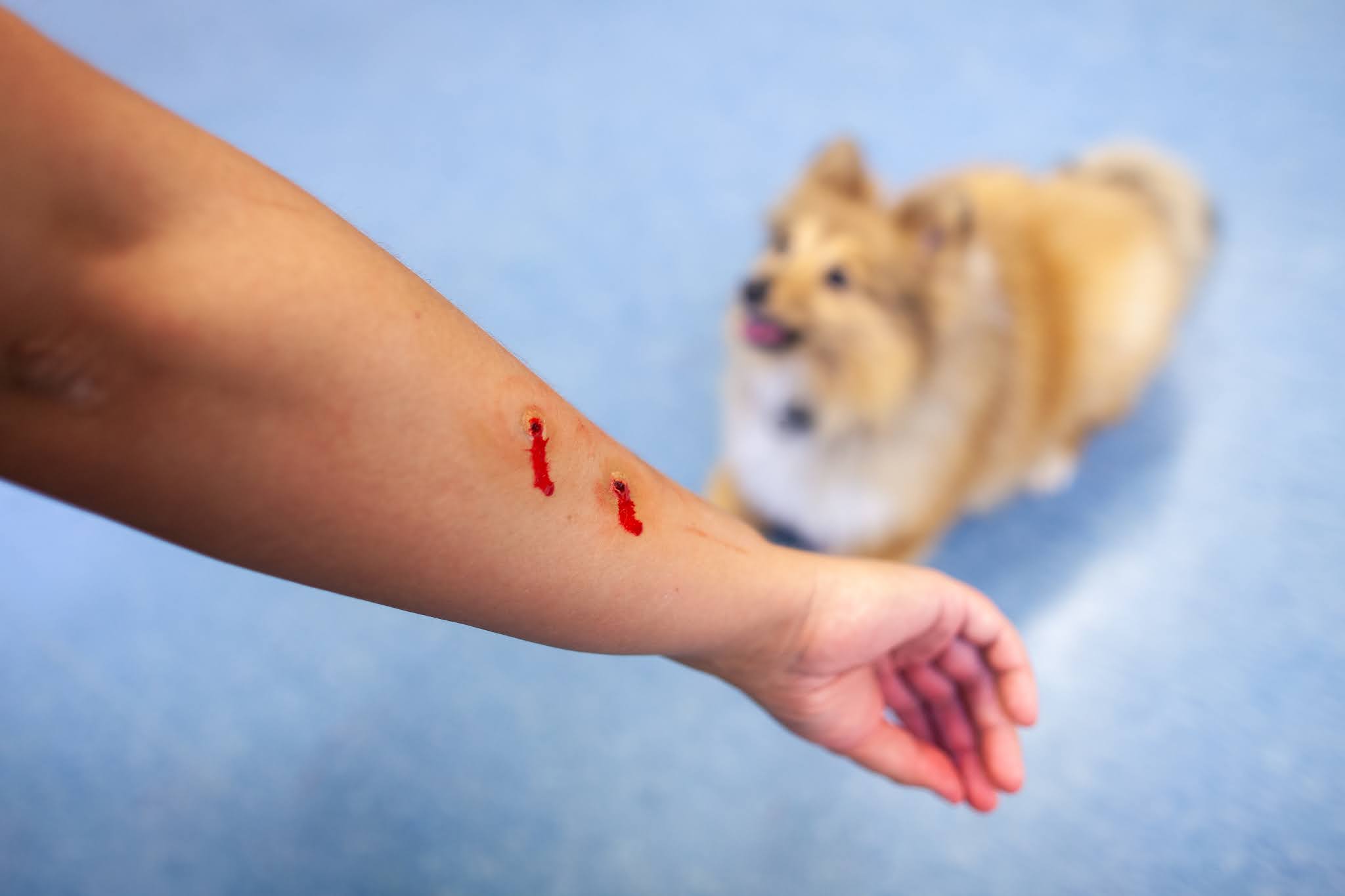 abogados de mordeduras de perro