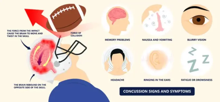 concussion-signs-and-symptoms