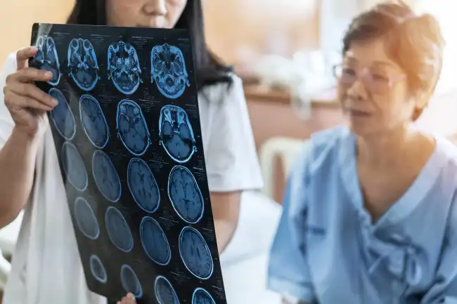 Brain scan after personal injury in inyo county