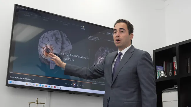 Lawyer explaining brain injury evidence during personal injury case review