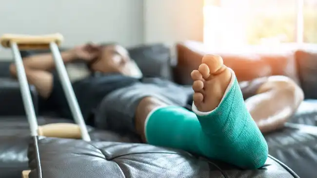 Injured man lying on bed with foot in a cast after a bike accident
