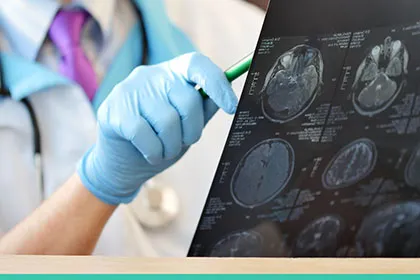 Las lesiones cerebrales no son fáciles de entender
