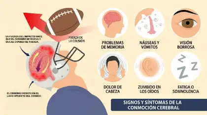 Síntomas de conmoción cerebral