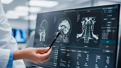 Escáner del cerebro de una persona tras sufrir una lesión cerebral