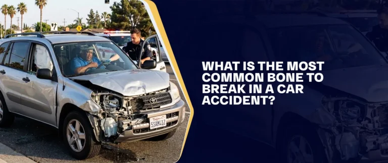 What Is the Most Common Bone to Break in a Car Accident